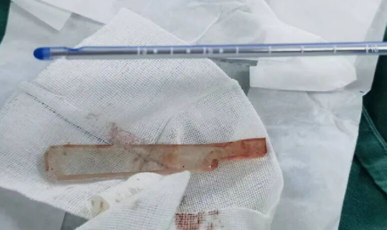 刀尖舞者——什邡市人民医院神经外科